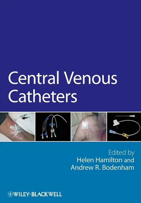 Cover of Central Venous Catheters