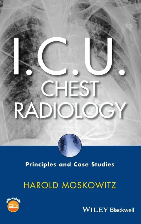 Cover of I.C.U. Chest Radiology