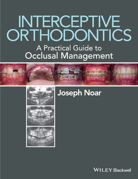 Cover of Interceptive Orthodontics