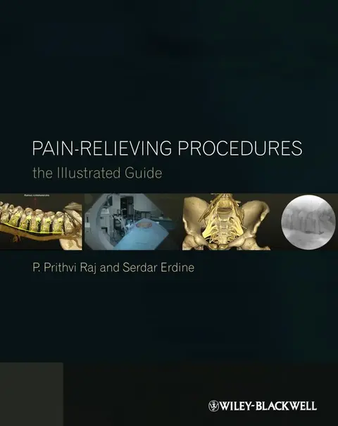 Cover of Pain-Relieving Procedures