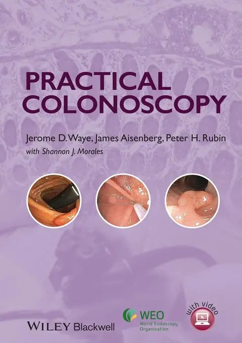 Cover of Practical Colonoscopy