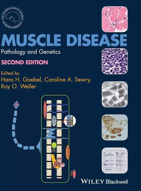 Cover of Muscle Disease