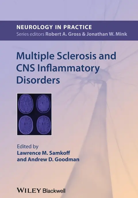 Cover of Multiple Sclerosis and CNS Inflammatory Disorders