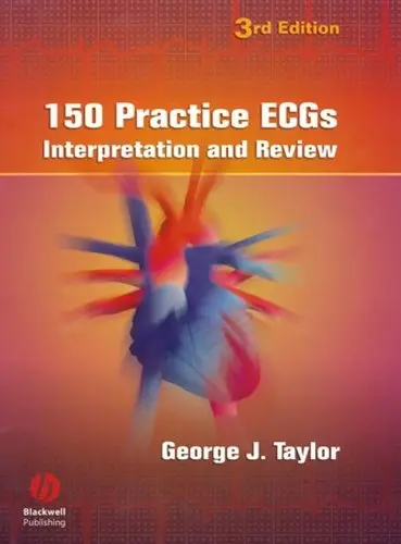 Cover of 150 Practice Ecgs