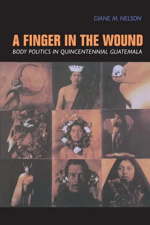 Cover of A Finger in the Wound