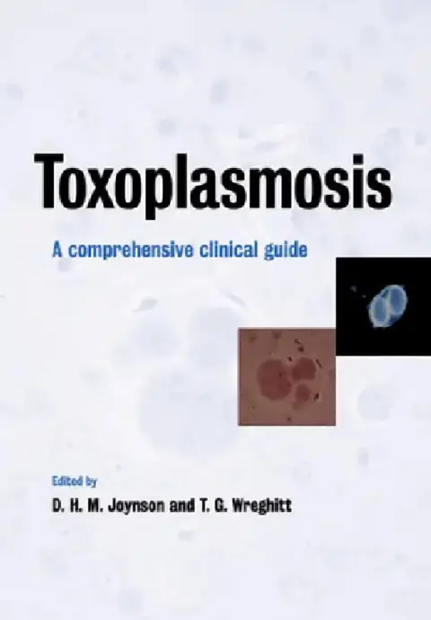 Cover of Toxoplasmosis
