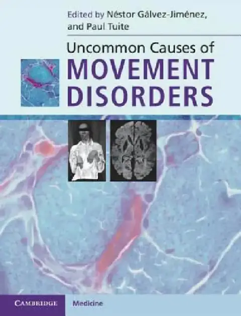 Cover of Uncommon Causes of Movement Disorders
