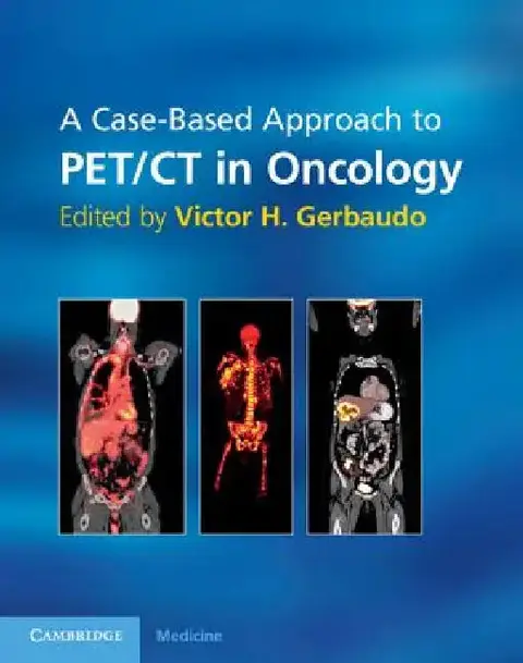 Cover of A Case-Based Approach to Pet/CT in Oncology