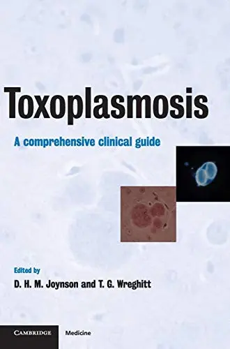 Cover of Toxoplasmosis