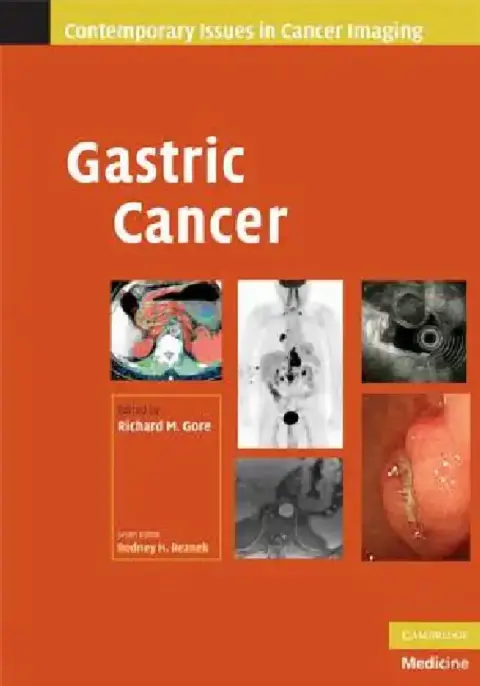 Cover of Gastric Cancer