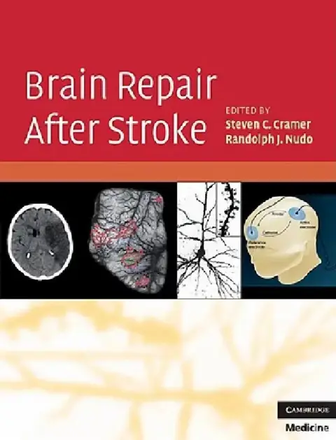 Cover of Brain Repair After Stroke