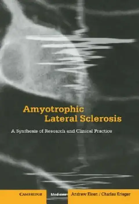 Cover of Amyotrophic Lateral Sclerosis