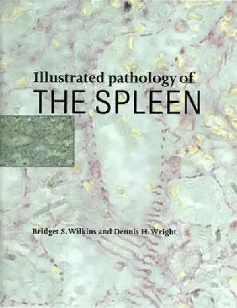 Cover of Illustrated Pathology of the Spleen