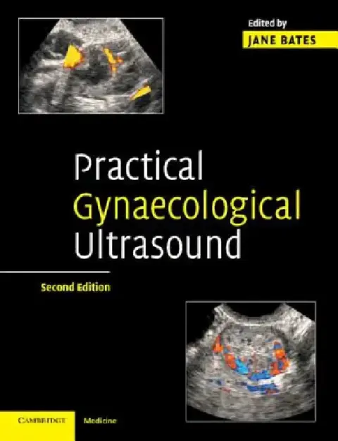 Cover of Practical Gynaecological Ultrasound