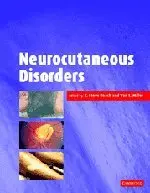Cover of Neurocutaneous Disorders