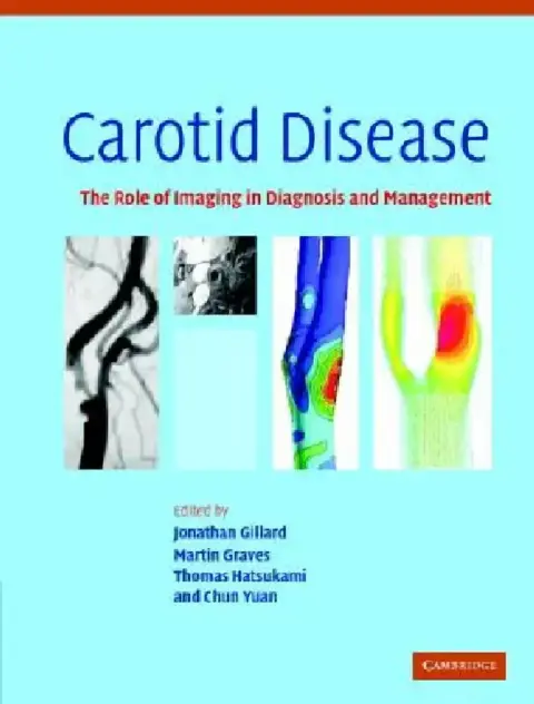 Cover of Carotid Disease