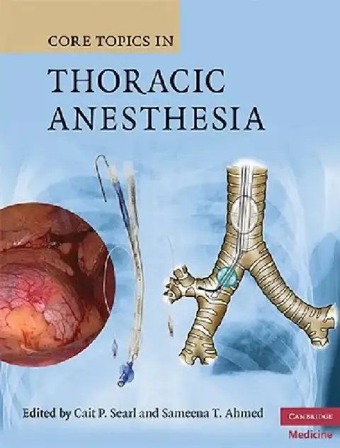 Cover of Core Topics in Thoracic Anesthesia
