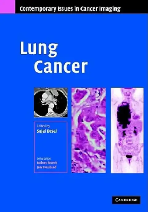 Cover of Lung Cancer