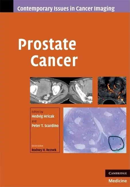Cover of Prostate Cancer