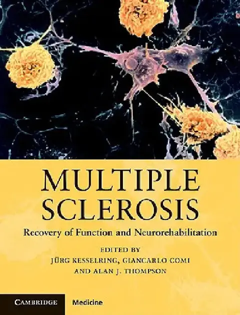 Cover of Multiple Sclerosis