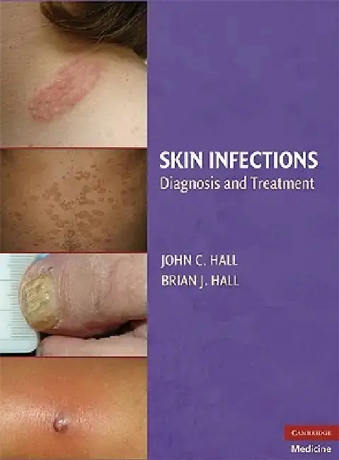 Cover of Skin Infections