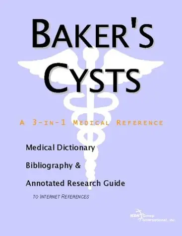 Cover of Baker's Cysts