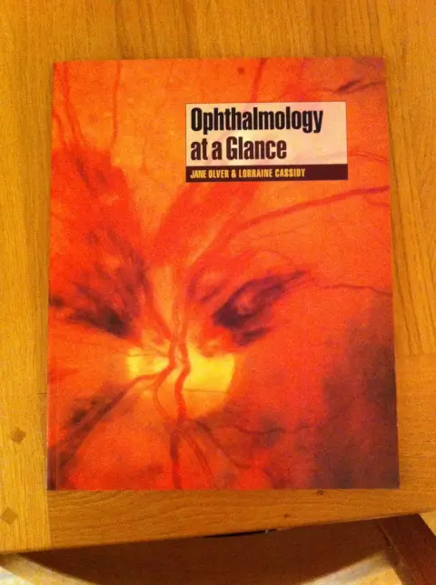 Cover of Ophthalmology at a Glance