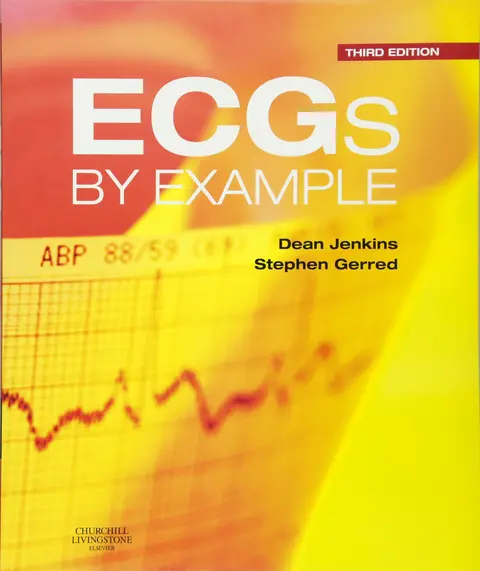 Cover of ECGs by Example