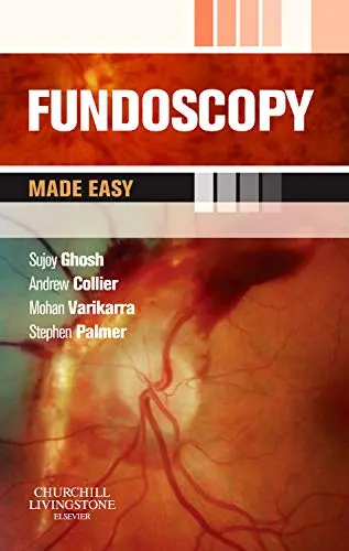 Cover of Fundoscopy Made Easy