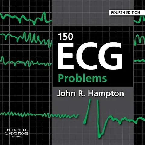 Cover of 150 ECG Problems, International Edition