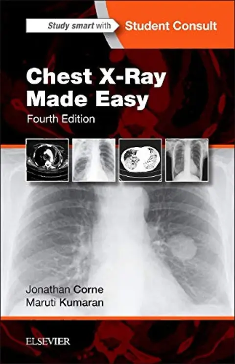 Cover of Chest X-Ray Made Easy