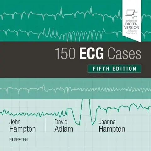 Cover of 150 ECG Cases