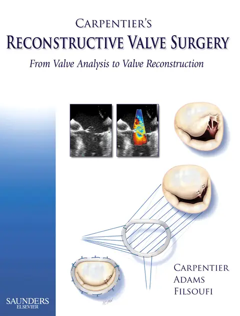 Cover of Carpentier's Reconstructive Valve Surgery