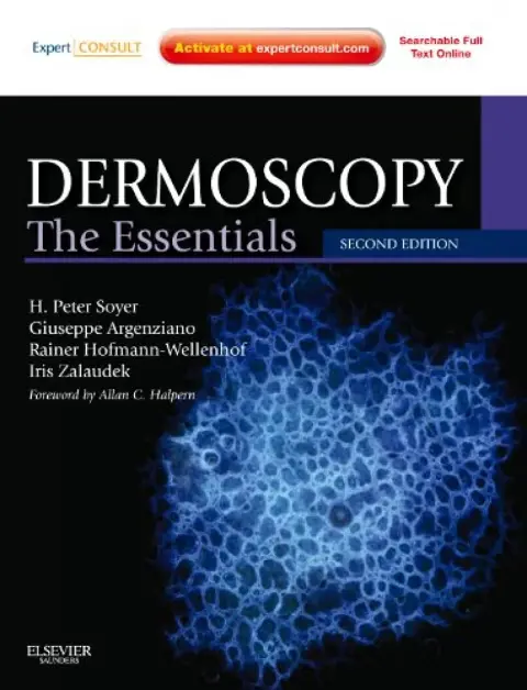 Cover of Dermoscopy