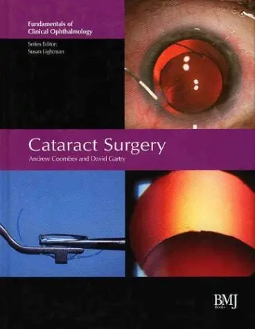 Cover of Cataract Surgery