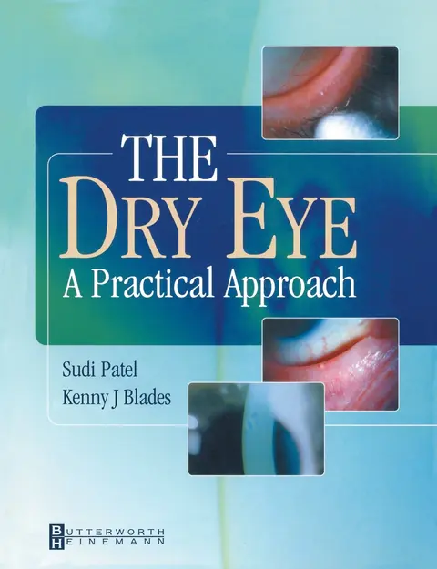 Cover of The Dry Eye