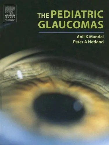 Cover of The Pediatric Glaucomas