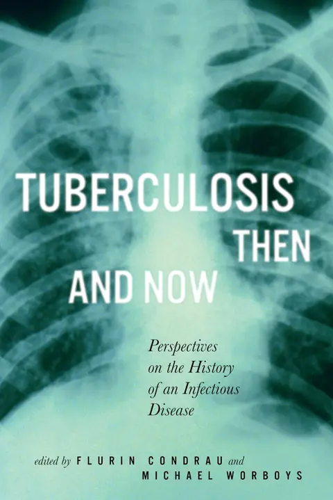 Cover of Tuberculosis Then and Now