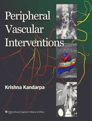 Cover of Peripheral Vascular Interventions