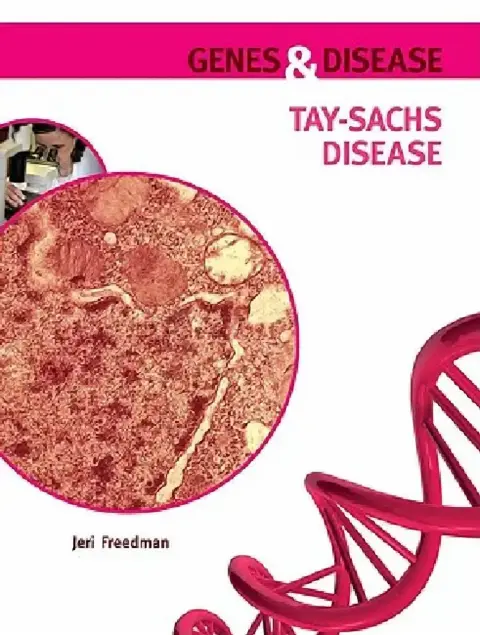 Cover of Tay-Sachs Disease
