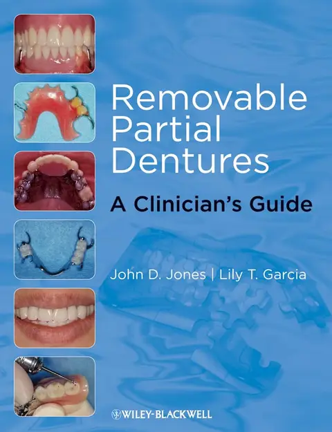 Cover of Removable Partial Dentures
