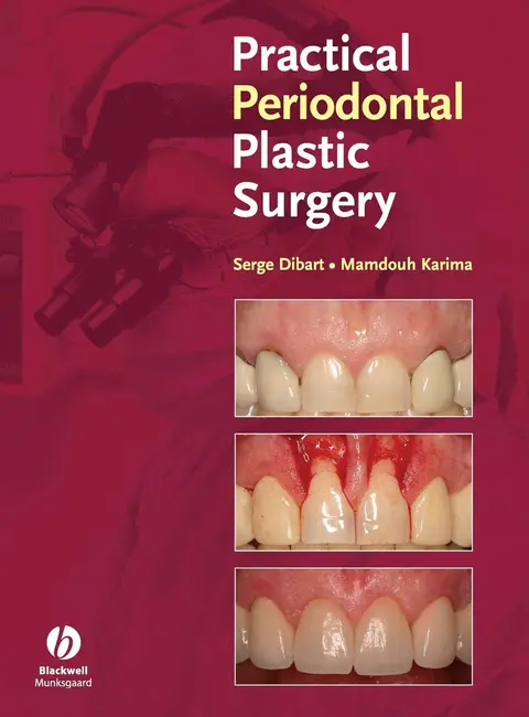 Cover of Practical Periodontal Plastic Surgery