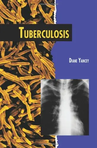 Cover of Tuberculosis