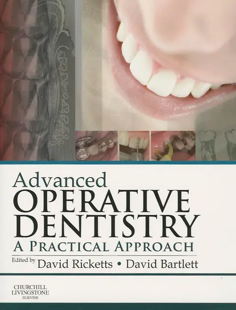Cover of Advanced Operative Dentistry