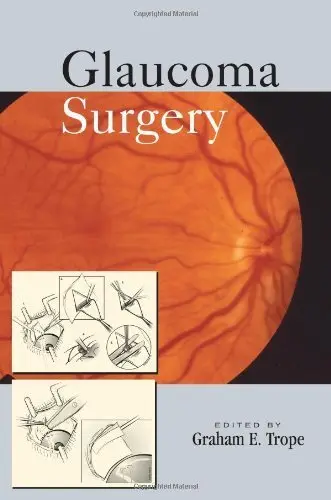 Cover of Glaucoma Surgery