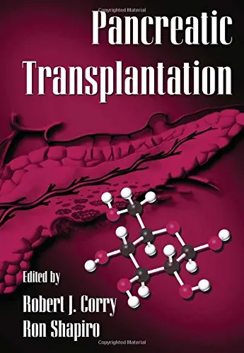 Cover of Pancreatic Transplantation