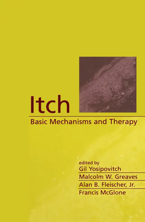 Cover of Itch