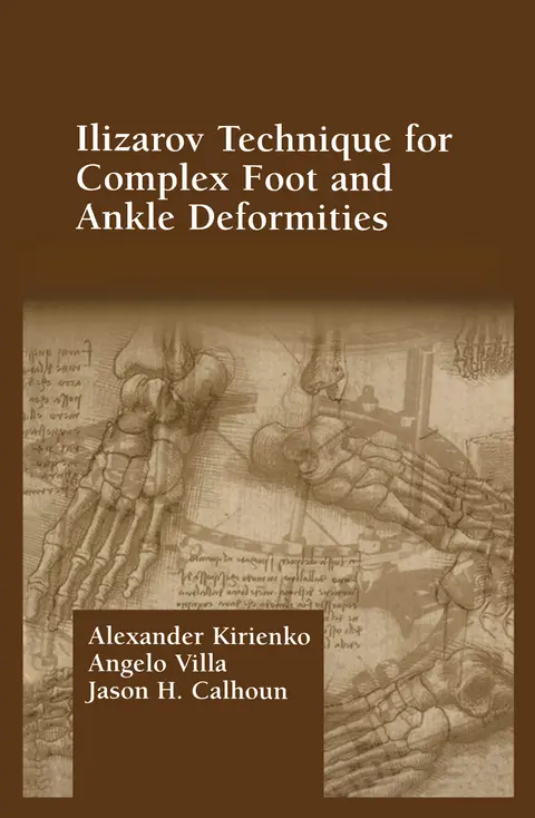 Cover of Ilizarov Technique for Complex Foot and Ankle Deformities