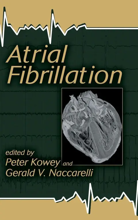 Cover of Atrial Fibrillation