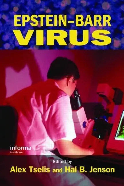 Cover of Epstein-Barr Virus